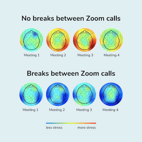 Blog image: Importance of scheduled breaks